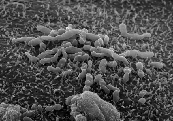 Mit dem Rasterelektronenmikroskop werden mit Orientia tsutsugamushi infizierte Zellen sichtbar. Das Bakterium verursacht das Tsutsugamushi-Fieber - eine der häufigsten Erkrankungen aus der Gruppe der Rickettsiosen. (Quelle: Christian Keller)